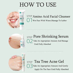 Anti Acne Removal Moisturizing Face Skin Care Kit